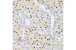 Immunohistochemistry of paraffin-embedded rat kidney using STAT4 antibody. (STAT4 Antikörper)