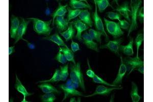 Immunofluorescent staining of HeLa cells using anti-TUBB4 mouse monoclonal antibody (ABIN2454621). (TUBB4 Antikörper)