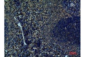 Immunohistochemistry (IHC) image for anti-Integrin alpha 4 (ITGA4) (Internal Region) antibody (ABIN3187778)