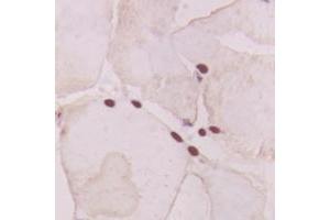 Immunohistochemistry (IHC) image for anti-Guanine Nucleotide Binding Protein (G Protein), alpha Transducing Activity Polypeptide 1 (GNAT1) (Center) antibody (ABIN7300746)