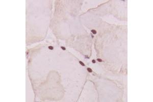 Immunohistochemical analysis of GNAT1 staining in human heart formalin fixed paraffin embedded tissue section. (GNAT1 Antikörper  (Center))