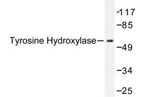 Image no. 1 for anti-Tyrosine Hydroxylase (TH) antibody (ABIN272085) (Tyrosine Hydroxylase Antikörper)