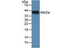Detection of Recombinant GAP43, Rat using Polyclonal Antibody to Growth Associated Protein 43 (GAP43) (GAP43 Antikörper  (AA 8-226))