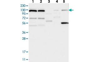 Western blot analysis of Lane 1: RT-4, Lane 2: U-251 MG, Lane 3: Human Plasma, Lane 4: Liver, Lane 5: Tonsil with DNAJC6 polyclonal antibody  at 1:250-1:500 dilution. (DNAJC6 Antikörper)