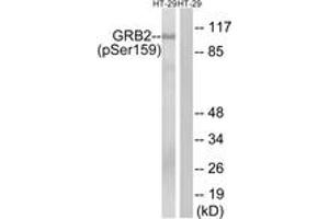 Western blot analysis of extracts from HT29 cells treated with serum 20% 15', using GRB2 (Phospho-Ser159) Antibody.