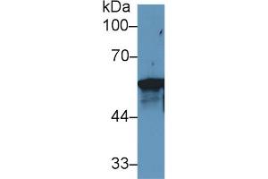 Western blot analysis of Human MCF7 cell lysate, using Rat KRT6A Antibody (1 µg/ml) and HRP-conjugated Goat Anti-Rabbit antibody ( (KRT6A Antikörper  (AA 323-461))