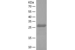 Western Blotting (WB) image for Small Nuclear Ribonucleoprotein Polypeptide A (SNRPA) (AA 1-255) protein (His tag) (ABIN7125131) (SNRPA1 Protein (AA 1-255) (His tag))