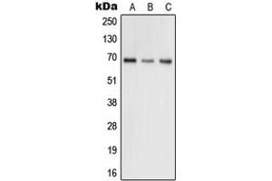 Western blot analysis of GRK5 expression in H9C2 (A), HEK293T (B), HeLa (C) whole cell lysates. (GRK5 Antikörper  (Center))