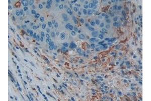 Immunohistochemistry (IHC) image for anti-Gelsolin (GSN) (AA 674-782) antibody (ABIN7442174)