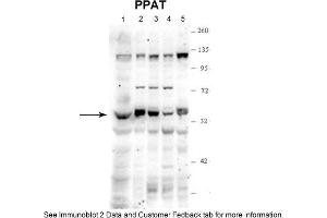 PPAT Antikörper  (N-Term)