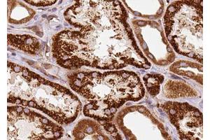 ABIN6272939 at 1/100 staining Human kidney tissue by IHC-P. (Centrin 1 Antikörper  (Internal Region))