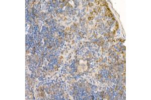 Immunohistochemistry of paraffin-embedded mouse spleen using [KO Validated] RA Rabbit pAb (ABIN3021646, ABIN3021647, ABIN3021648 and ABIN1513457) at dilution of 1:100 (40x lens). (RAB5 Antikörper  (AA 1-215))