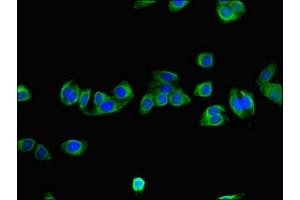 Immunofluorescent analysis of HepG2 cells using ABIN7161568 at dilution of 1:100 and Alexa Fluor 488-congugated AffiniPure Goat Anti-Rabbit IgG(H+L) (NNMT Antikörper  (AA 86-157))