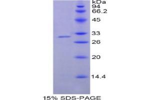 SDS-PAGE analysis of Human NNMT Protein. (NNMT Protein)