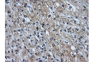 Immunohistochemical staining of paraffin-embedded liver tissue using anti-BIRC7mouse monoclonal antibody. (BIRC7 Antikörper)