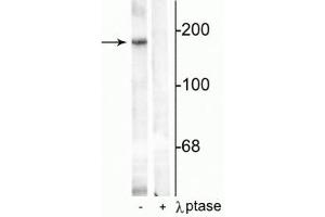 Western blot of rat hippocampal lysate showing specific immunolabeling of the ~180 kDa NR2B subunit phosphorylated at Tyr1336 in the first lane (-). (GRIN2B Antikörper  (pTyr1336))