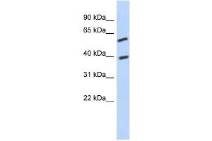 WB Suggested Anti-C6orf146 Antibody Titration: 0. (FAM217A Antikörper  (Middle Region))
