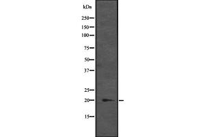 Western blot analysis of CENPM expression in K-562 cell lysate at 25ug/lane,The lane on the left is treated with the antigen-specific peptide. (CENPM Antikörper  (Internal Region))