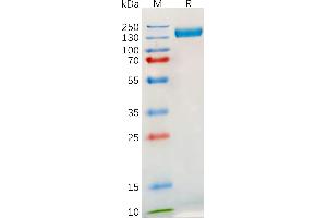 SDS-PAGE (SDS) image for Toll-Like Receptor 3 (TLR3) (AA 28-80) protein (Fc Tag) (ABIN6964333)