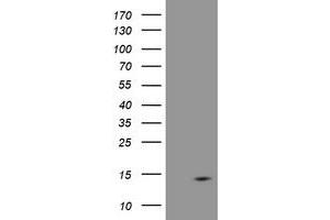Image no. 4 for anti-D-Dopachrome Tautomerase (DDT) antibody (ABIN1497798)