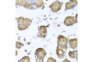 Immunohistochemistry of paraffin-embedded human stomach using TUBB8 antibody.