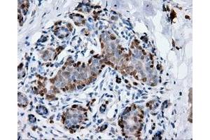 Immunohistochemical staining of paraffin-embedded breast tissue using anti-ANXA1 mouse monoclonal antibody. (Annexin a1 Antikörper)