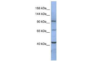 WB Suggested Anti-RBM12  Antibody Titration: 0.