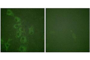 Immunofluorescence staining of methanol-fixed HuvEc cells using Histamine H1 Receptor (Phospho-Ser398) Antibody. (HRH1 Antikörper  (pSer398))