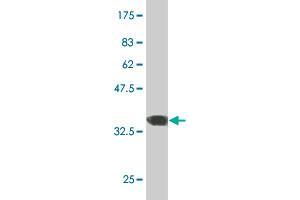 Western Blot detection against Immunogen (36. (ERN1 Antikörper  (AA 401-500))