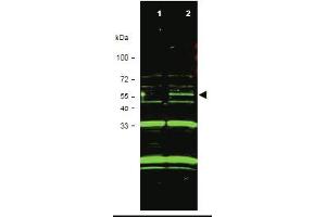 Western blot using anti-ING3 antibody shows detection of a band at. (ING3 Antikörper  (Isoform 1))