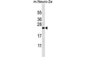 ZCRB1 Antibody (C-term) western blot analysis in mouse Neuro-2a cell line lysates (35 µg/lane). (ZCRB1 Antikörper  (C-Term))