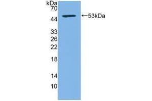 Detection of Recombinant CD83, Human using Polyclonal Antibody to Cluster Of Differentiation 83 (CD83) (CD83 Antikörper  (AA 24-205))