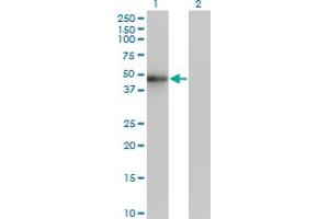 Western Blot analysis of ZNF24 expression in transfected 293T cell line by ZNF24 monoclonal antibody (M02), clone 2G5. (ZNF24 Antikörper  (AA 1-368))