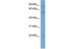 Image no. 1 for anti-RAB11 Family Interacting Protein 5 (Class I) (RAB11FIP5) (N-Term) antibody (ABIN6745683) (RAB11FIP5 Antikörper  (N-Term))