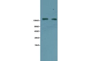 Human rectal carcinoma lysates probed with Anti Phospho-TIF1 beta(Ser824) Polyclonal Antibody, Unconjugated (ABIN746108) at 1:200 overnight at 4 °C.