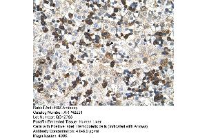 Rabbit Anti-HBZ Antibody  Paraffin Embedded Tissue: Human Liver Cellular Data: Hemopoietic Antibody Concentration: 4.