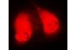 Immunofluorescent analysis of GGA2 staining in MCF7 cells.