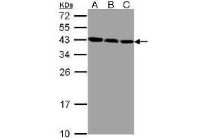 WB Image Sample(30 ug whole cell lysate) A:293T B:MOLT4 , C:Raji , 12% SDS PAGE antibody diluted at 1:1000
