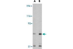 Western blot analysis of TNPO3 in Raji cell lysate with TNPO3 polyclonal antibody  at (A) 1 and (B) 2 ug/mL . (Transportin 3 Antikörper  (N-Term))