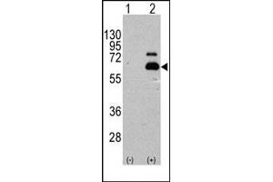 Image no. 1 for anti-Ribosomal Protein S6 Kinase, 70kDa, Polypeptide 1 (RPS6KB1) (Ser404) antibody (ABIN358257) (RPS6KB1 Antikörper  (Ser404))