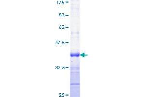 Image no. 1 for Insulin-Like Growth Factor 2 (IGF2) (AA 25-114) protein (GST tag) (ABIN1307550)