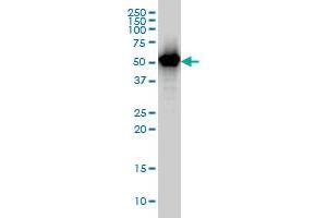 TAPBPL monoclonal antibody (M02), clone 6E3 Western Blot analysis of TAPBPL expression in A-431 .