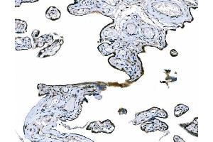 IHC analysis of CD101 using anti-CD101 antibody (ABIN7601981).