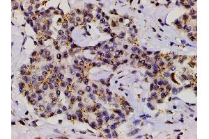 Immunohistochemistry (IHC) image for anti-LIM Domain Kinase 1 (LIMK1) (pThr508) antibody (ABIN6255701)