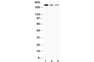 Western blot testing of 1) rat testis, 2) mouse Hepa1-6 and 3) human HepG2 lysate with TECTA antibody at 0.