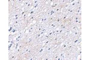 Immunohistochemical staining of human brain tissue using AP30122PU-N BAP3 antibody at 2. (BAIAP3 Antikörper  (N-Term))