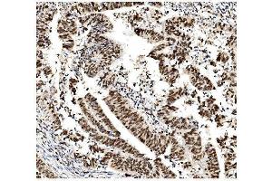 IHC analysis of MCM2 using anti-MCM2 antibody (ABIN7601594). (MCM2 Antikörper  (AA 393-850))
