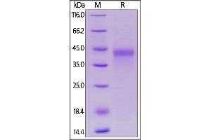 Marmoset OX40, His Tag on  under reducing (R) condition. (TNFRSF4 Protein (AA 29-214) (His tag))
