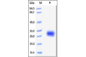 SDS-PAGE (SDS) image for Folate Receptor 2 (Fetal) (FOLR2) (AA 17-228) protein (His tag) (ABIN2181119) (FOLR2 Protein (AA 17-228) (His tag))