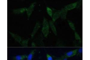 Immunofluorescence analysis of NIH-3T3 cells using ZWINT Polyclonal Antibody at dilution of 1:100 (40x lens). (ZWINT Antikörper)